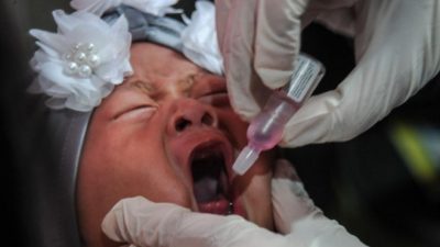45.000 Anak di Kota Mataram Sudah Terima Imunisasi Polio